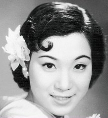 島倉千代子の若い頃は？幼少期に大怪我！この世の花！美空ひばりの？